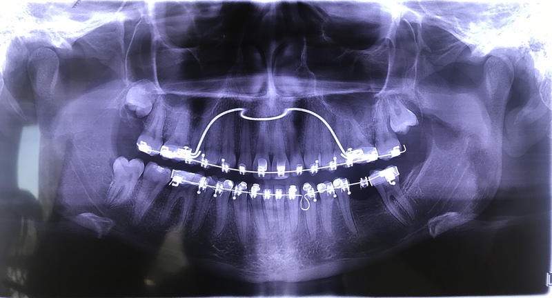 Figura_4_Radiografia panoramica final.jpg