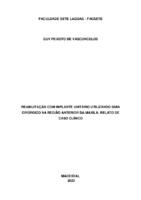 artigo implante-GUY.pdf